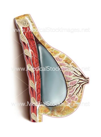 Facts About Breast Augmentation