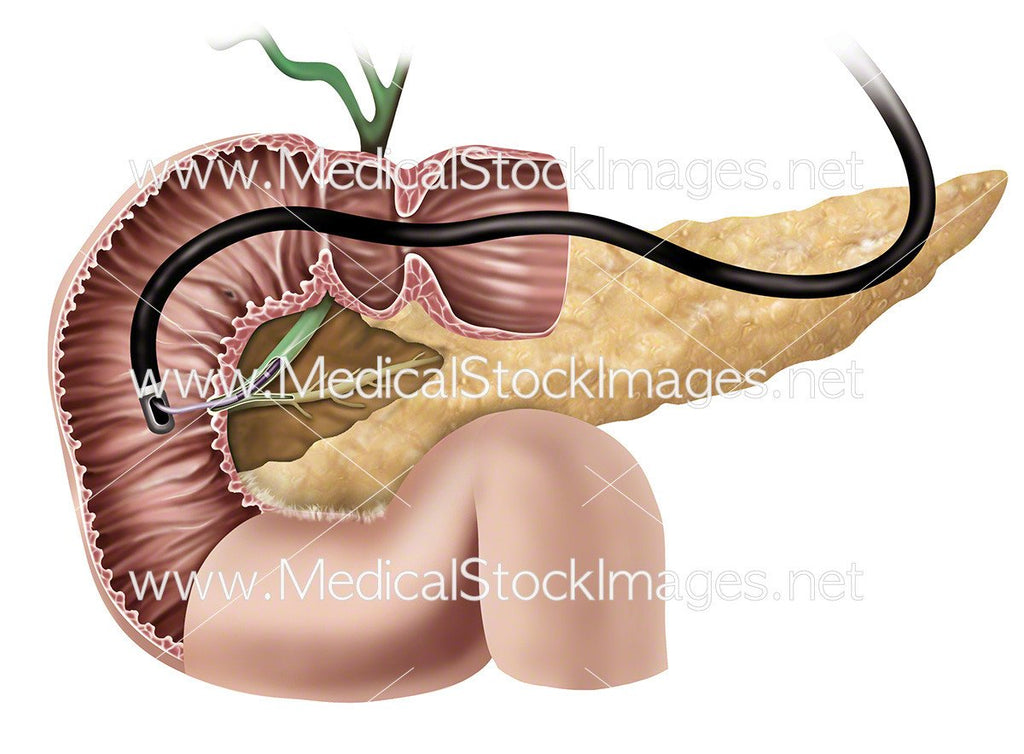 Facts About the Human Pancreas