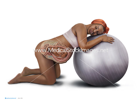 Use of a Birthing Ball (Birth ball) - (African heritage)
