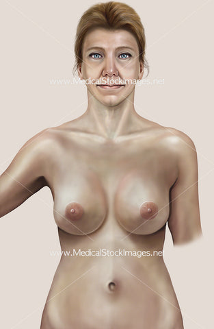 Female Upper Body Anterior View