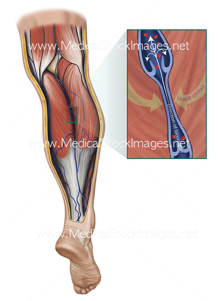 Calf Pump Showing Venous Return Flow Contracted Medical Stock Images Company