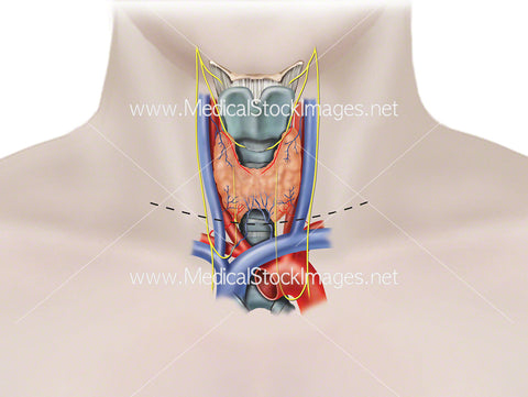 Thyroid Gland and Position of Surgical Incision