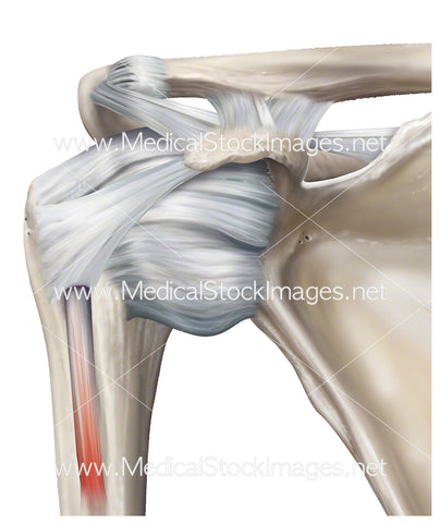 Shoulder Glenohumeral Joint Ligaments