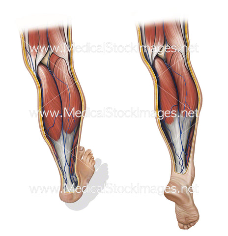 Venous Flow with Calf Pump Relaxed and Contracted