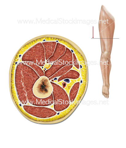 Transverse Section of the Leg