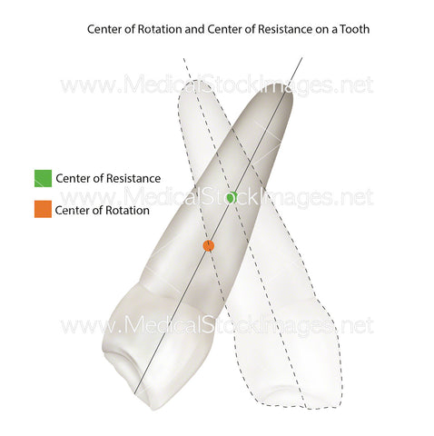 Center of Rotation and Center of Resistance of Tooth (US Version)