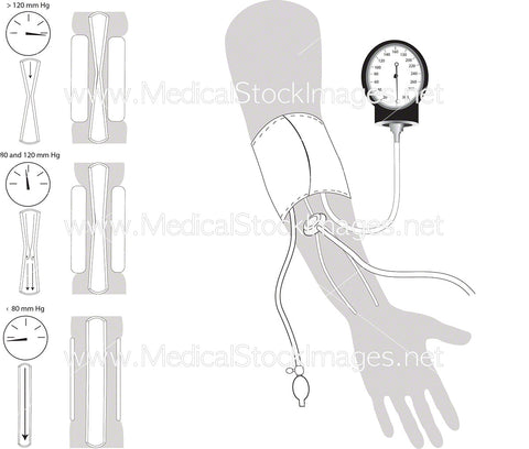 Arterial or Blood Pressure Measurement
