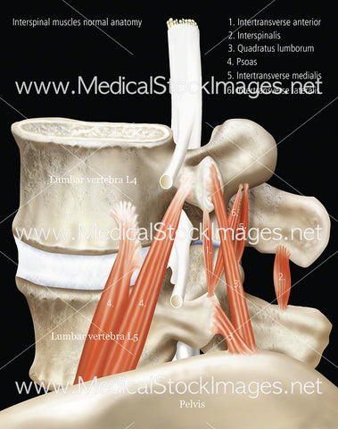 Interspinal- Muscle Normal Anatomy with Labels and Black Background