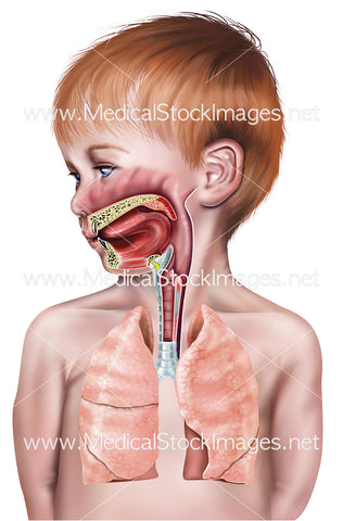 Upper Airway of Young Male Child