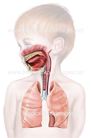 Upper Airway of Young Child with Opaque Background