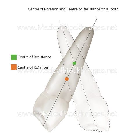 CENTRE OF ROTATION AND CENTRE OF RESISTANCE OF TOOTH (UK VERSION)