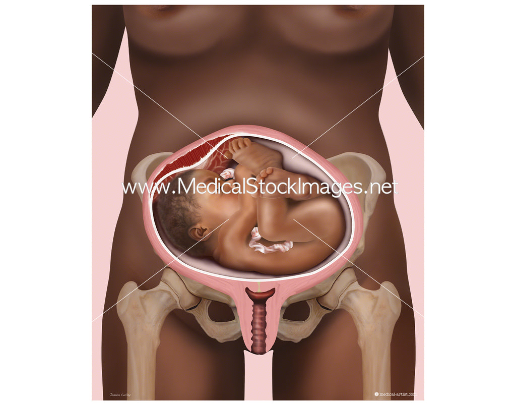 Transverse lying baby sales