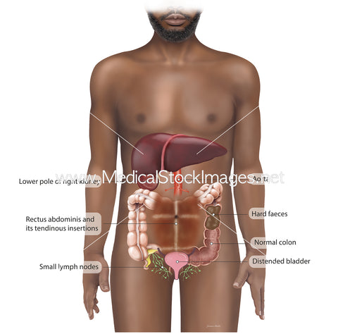 Surface Anatomy of the Abdomen Palpated During Clinical Assessment