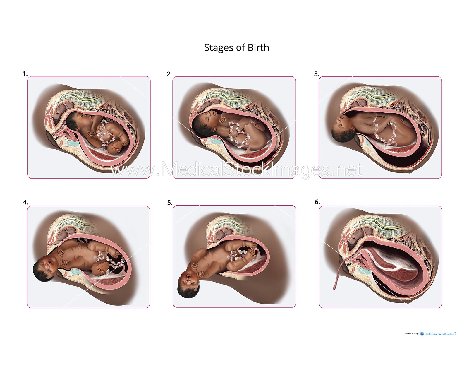 Giving Birth Diagram