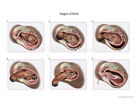 Giving Birth Stages (African heritage)