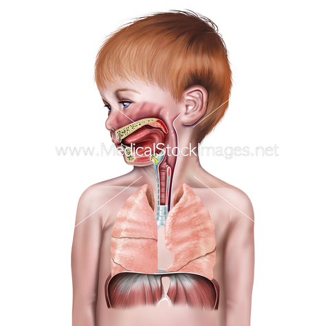 Upper and Lower Airway Anatomy (Child)