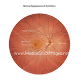 Labelled Normal Retina Fundoscopy View Illustration