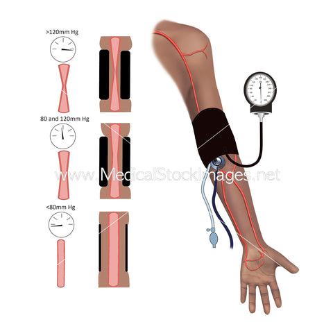 Blood Pressure Cuff Illustration