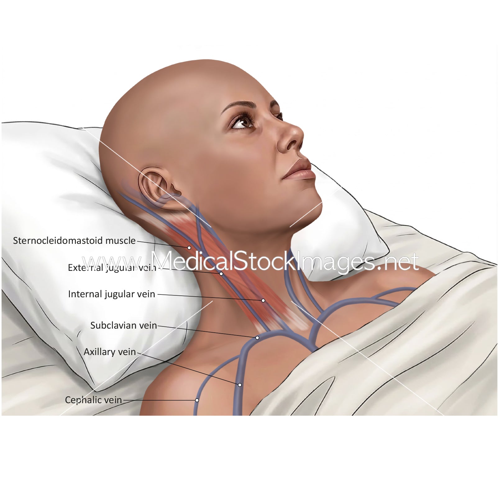 Jvp Examining Jugular Venous Pressure (JVP) Illustration – Medical Stock ...