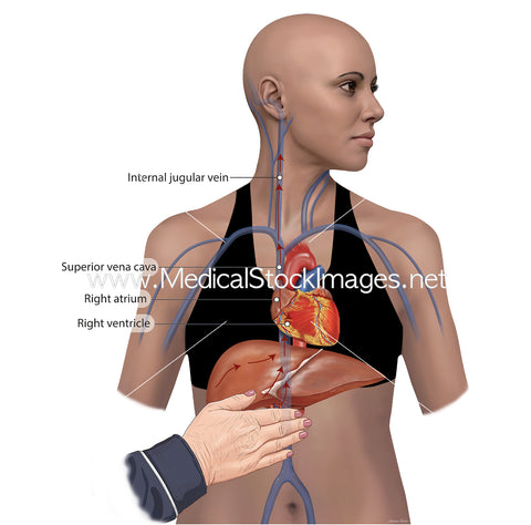 Anatomy and Blood Flow in the Hepatojugular Reflux