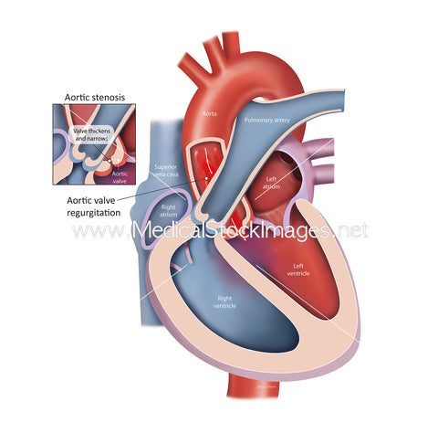 Diagram of a heart with labeled parts and annotations on a white background