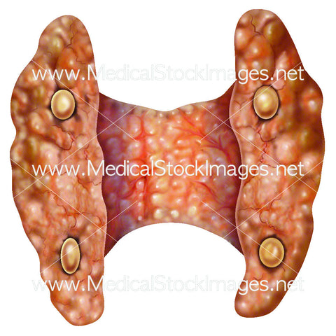 Parathyroid Glands