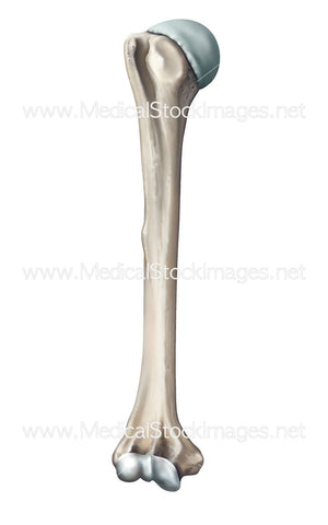 Humerus Bone