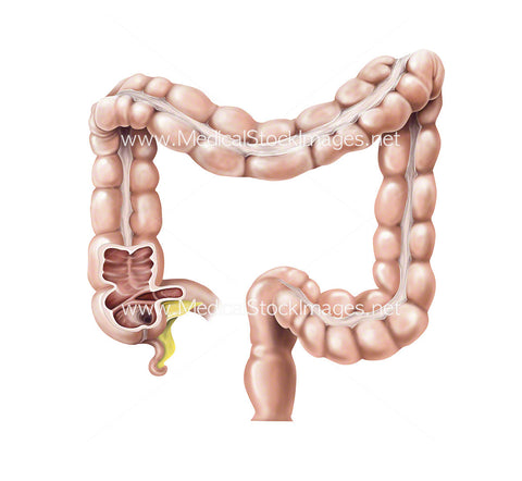 Large Bowel Illustration