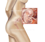 Foetus Development Weeks 1 to 40 Including Female Body - (PACK OF 40 IMAGES)