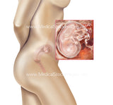 Foetus Development Weeks 1 to 40 Including Female Body - (PACK OF 40 IMAGES)