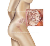 Foetus Development Weeks 1 to 40 Including Female Body - (PACK OF 40 IMAGES)