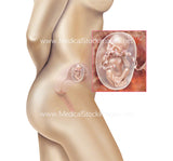 Foetus Development Weeks 1 to 40 Including Female Body - (PACK OF 40 IMAGES)