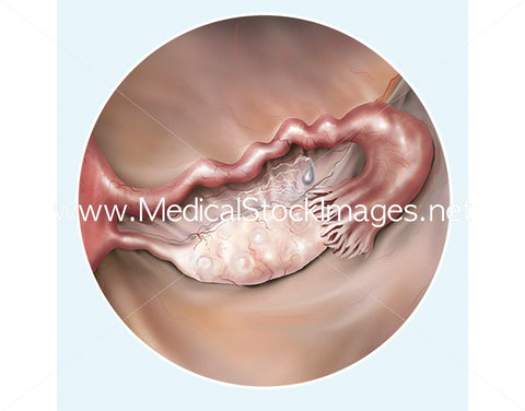 Foetus Development Illustrations Weeks 1 to 40 - (Multipack of 40 IMAGES)