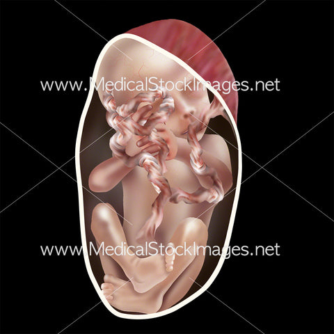 Foetus Development Week 21