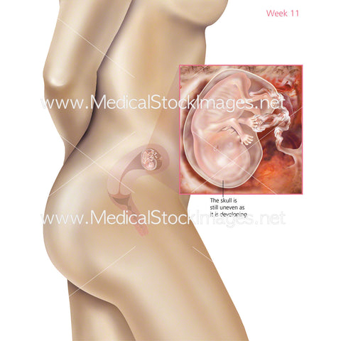 Foetus Development Week 11 Including Body with Labels