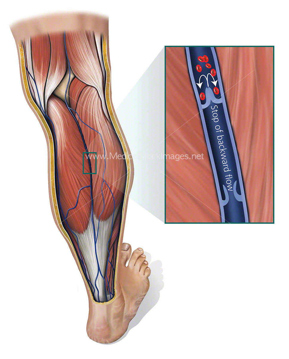 Calf Pump Showing Venous Return Flow Medical Stock Images Company