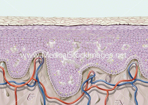 Skin Cell Alignment Skin Medical Images & Illustrations | Healthy, Diseased, Conditions of ...