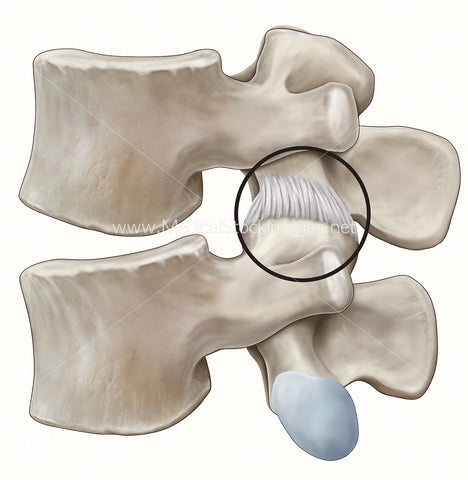 Facet Joint Location