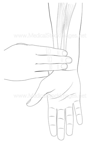 Neiguan Acupuncture Point with No Labels