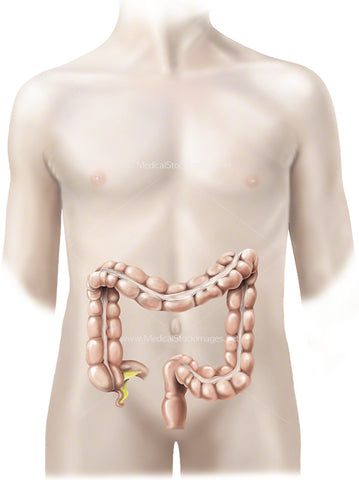 Large Bowel Anatomy (Adolescent)