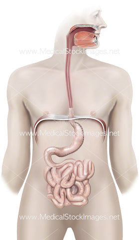 Sleeve Gastrectomy Procedure