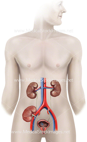 Kidney Transplant Procedure