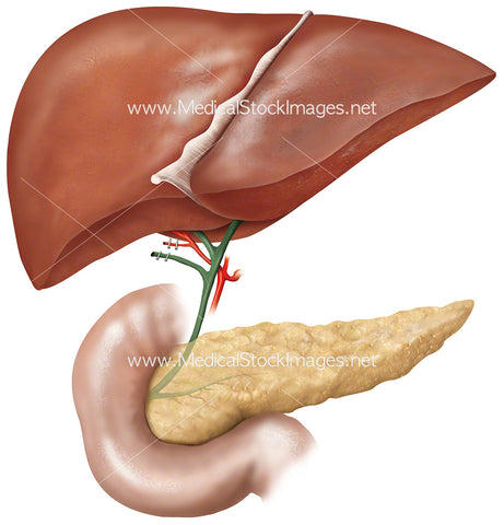 Cystic Duct Artery Removal