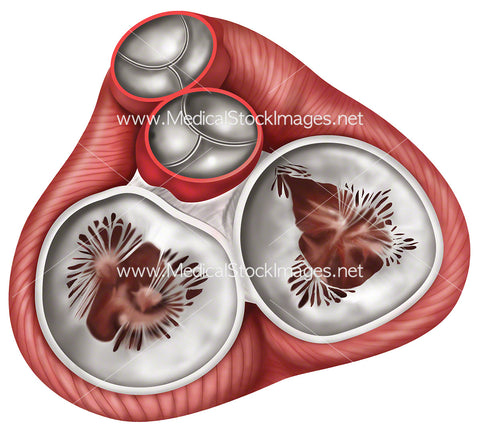 Heart Valves in Diastole