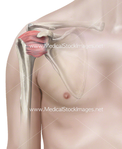 Frozen Shoulder Joint on Male Figure