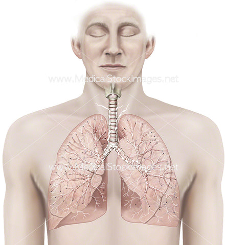 Thoracic Lymph Nodes and Lungs