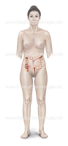 Female Inflamed Appendix