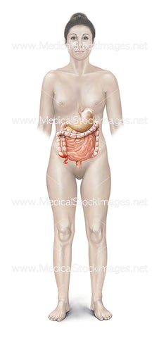Female with an Inflamed Appendix