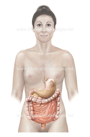 Female with Stomach Pancreas and Bowel
