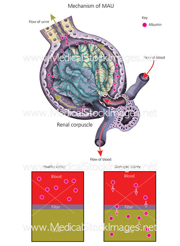 MAU Diagram